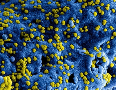 RTE Brainstorm Analysis: ‘How the coronavirus may hit the tourism industry’, Professor Jim Deegan